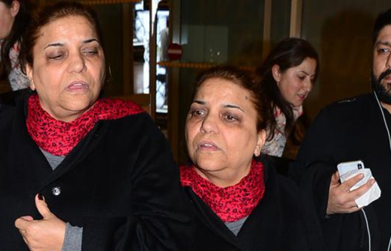 Kibariye: Bacaklarım tutmuyor