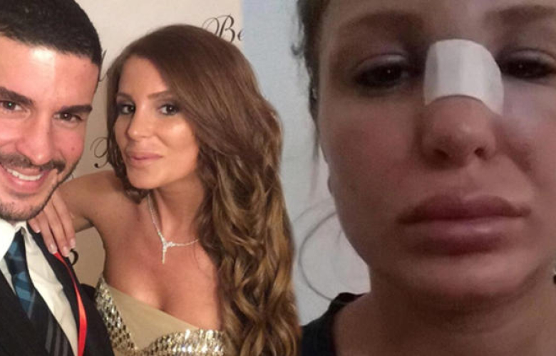 Berk Oktay'ın eşinden sosyal medyayı sallayan paylaşım! "Kocam beni dövdü yardım edin!"