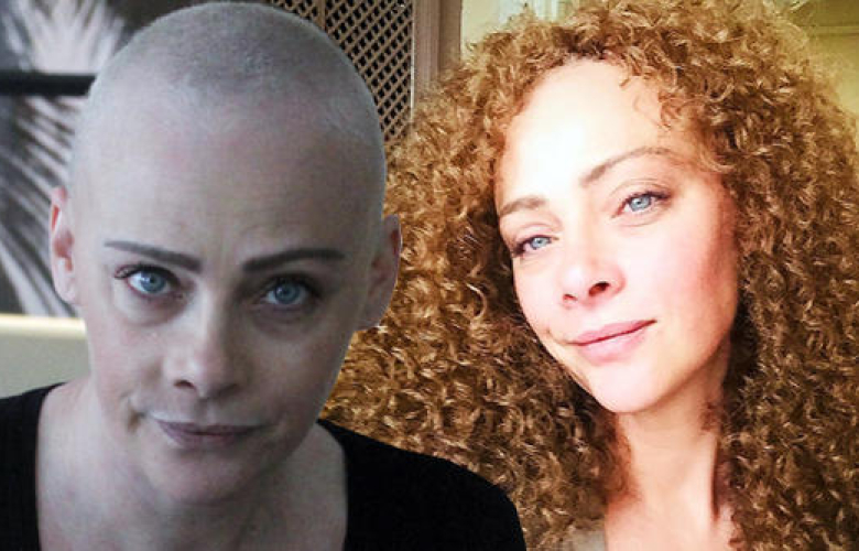 Oyuncu Dilek Serbest'in saçlarına ne oldu? 