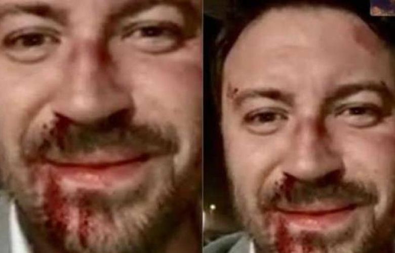 Ünlü oyuncu Tolga Güleç kavgaya mı karıştı? 