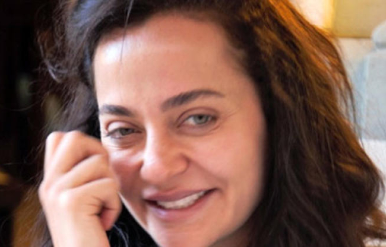 Estetik yaptırdı, kabusu yaşadı! Ünlü oyuncunun zor günleri...