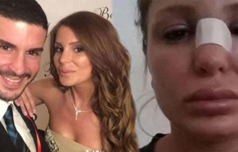 Merve Oktay'dan Berk Oktay'a cevap "Ben de uzlaşmak istemiyorum"