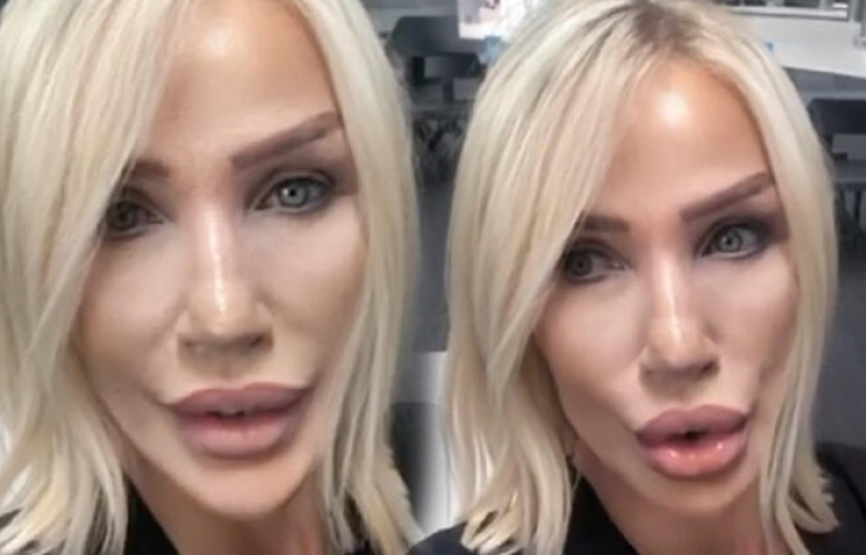 Fransız askısı ve dudak liftingi yaptırmıştı... İşte Seda Sayan'ın son hali...