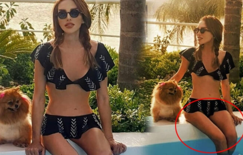 Seren Serengil'in paylaşımı olay oldu! 'Diğer bacağı unutmuşsun'