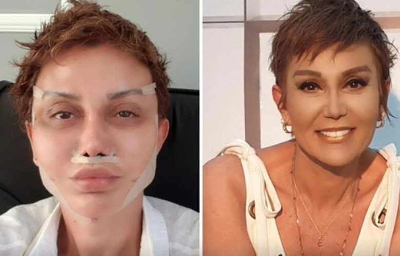 Ünlü sunucu Serap Paköz '“Benim neyim eksik' dedi! Bıçak altına yattı...