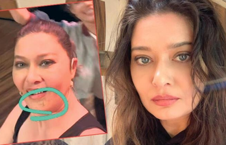 Fren yerine gaza basmış!