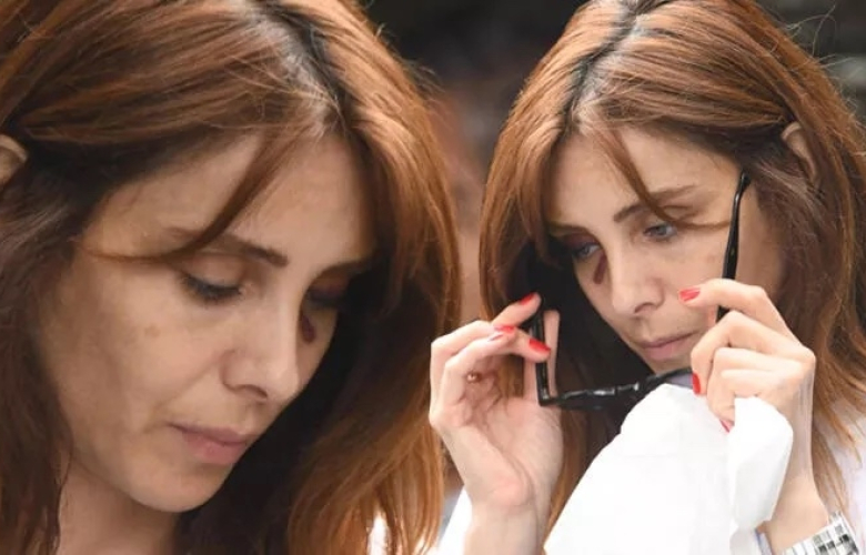 Nur Fettahoğlu gözlükle kapatmaya çalıştı ama.. Talihsiz kaza!