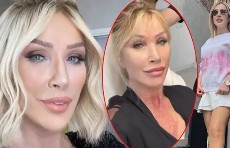 Seda Sayan yine estetik yaptırdı!