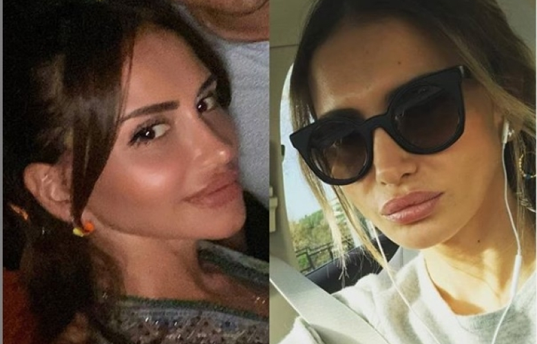 Emina Jahoviç'in günden güne değişen çenesi artık dikkat çekmeye başladı