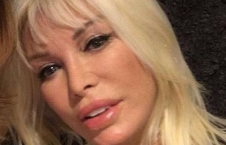 Ajda Pekkan ameliyat oldu