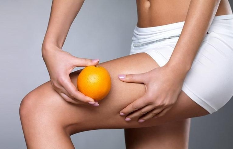 Kadınların En Büyük Sorunu Selülit İçin Tedaviler